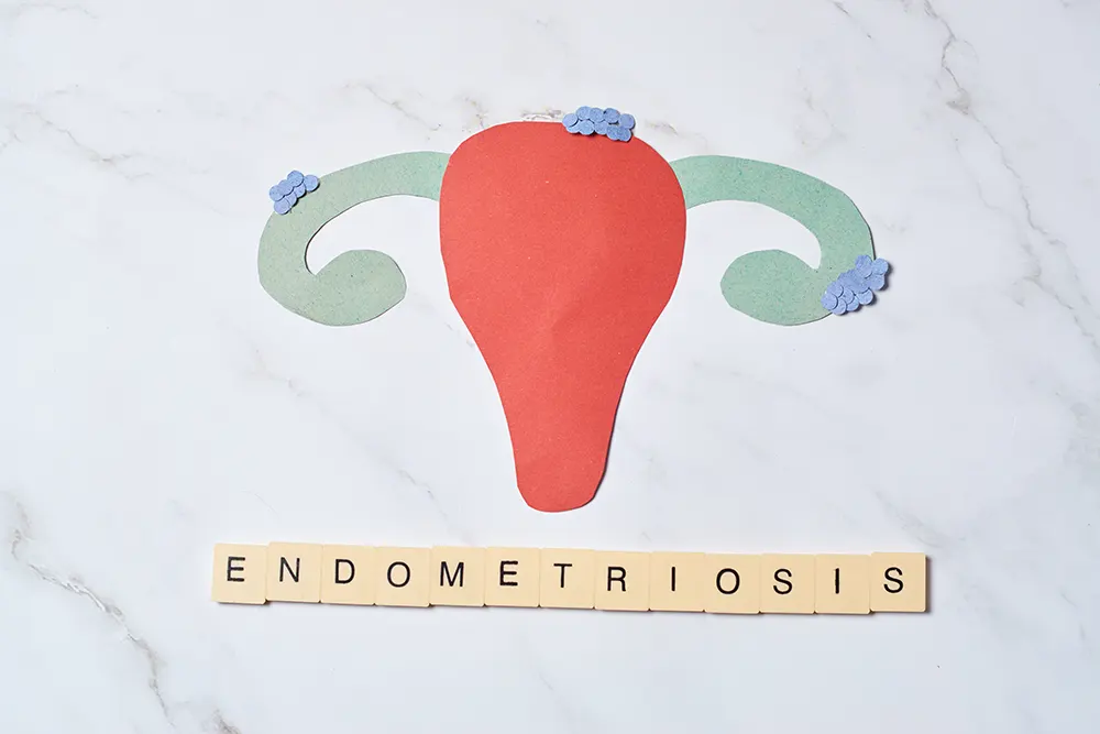 Hysterectomy Endometriosis