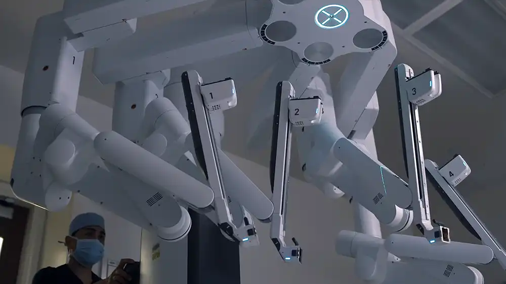Robotic limbs