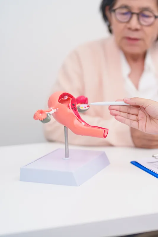 A hand pointing with a pen at the ovary on an anatomical model of the uterus, fallopian tubes and ovaries, with an older woman wearing glasses blurred in the background