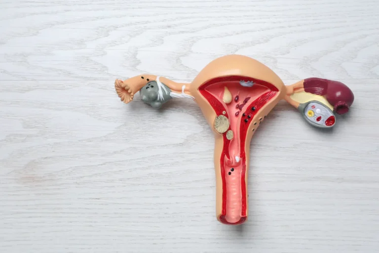 Cross-section model of the uterus, fallopian tubes and ovaries lying on a white wooden surface