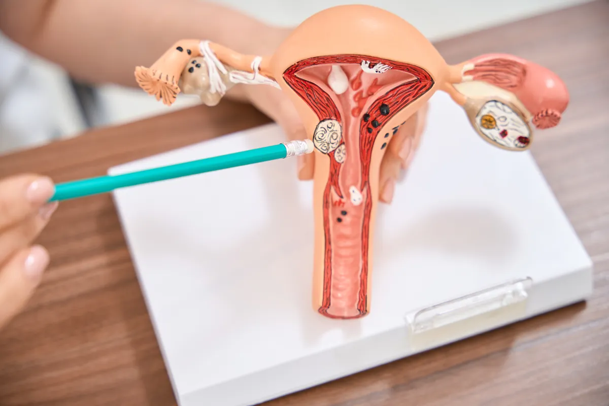 Anatomical model of the uterus and ovaries on a desk, with a green pointer held next to it